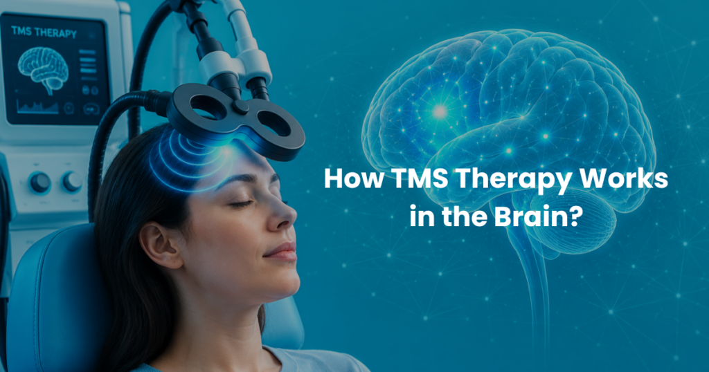 Illustration showing how TMS Therapy stimulates brain activity to help treat depression and improve mood regulation.